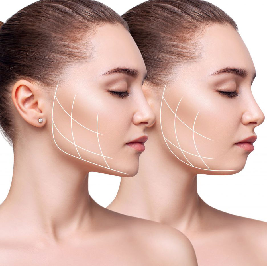 Fat dissolving injectable treatment at Alicia Beauty