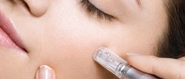 MICRO NEEDLING